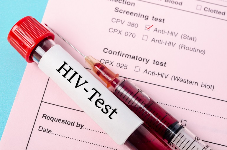 El retraso en el diagnóstico de la infección por VIH de las embarazadas conlleva un peor pronóstico de la enfermedad en sus hijos