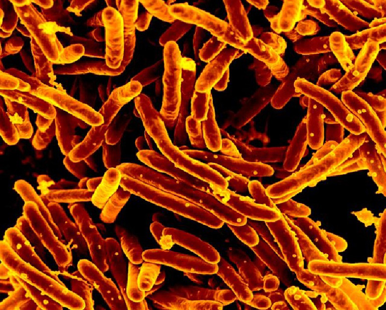 Bacteria causante de la tuberculosis