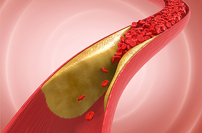 El colesterol en números rojos: los expertos avisan de un repunte tras la Navidad