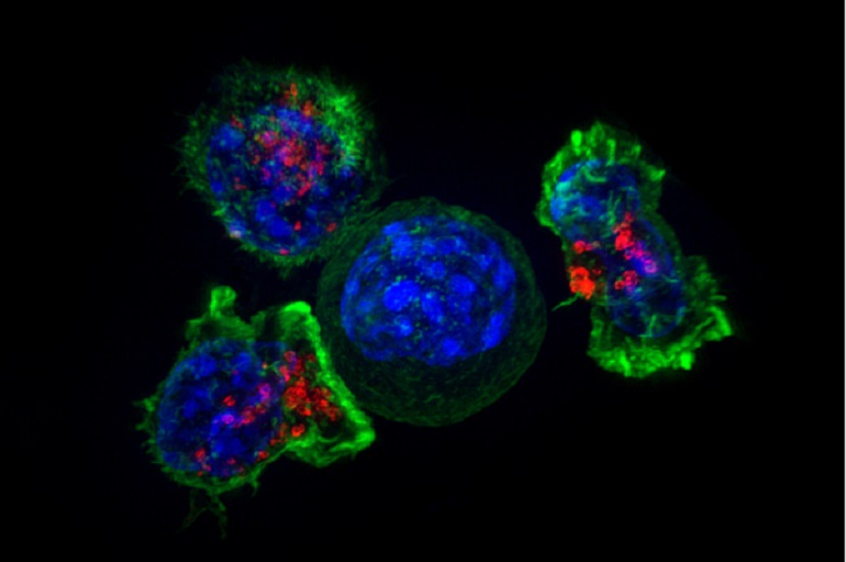 Las células T que &#8216;mordisquean&#8217; los tumores ayudan al cáncer a evadir la respuesta inmunitaria