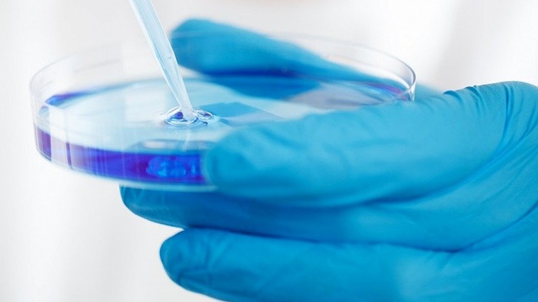 Un ensayo internacional estudia cómo evitar la quimioterapia en cáncer de mama localizado HER-2 positivo
