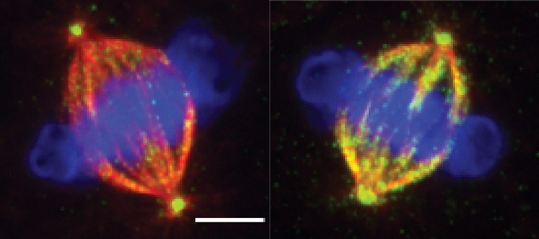 Una enzima del proceso de división celular identificada como potencial nueva diana terapéutica para el cáncer 