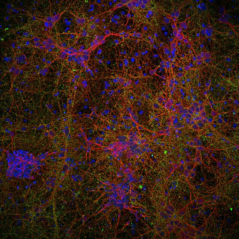 Nanotecnología para reparar lesiones medulares