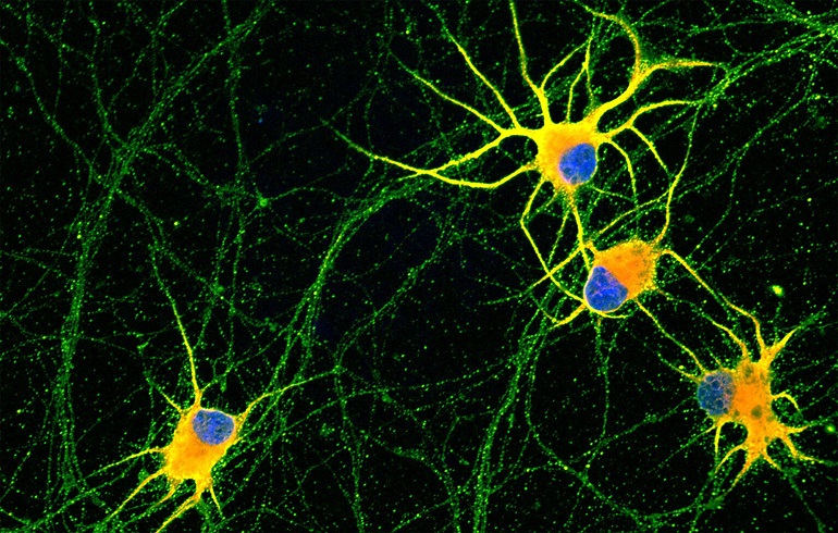 Logran cultivar neuronas maduras en el laboratorio para estudiar enfermedades neurodegenerativas