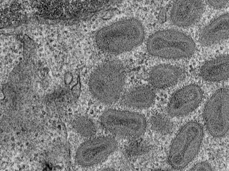 Identificada una proteína clave en la entrada de los poxvirus a las células