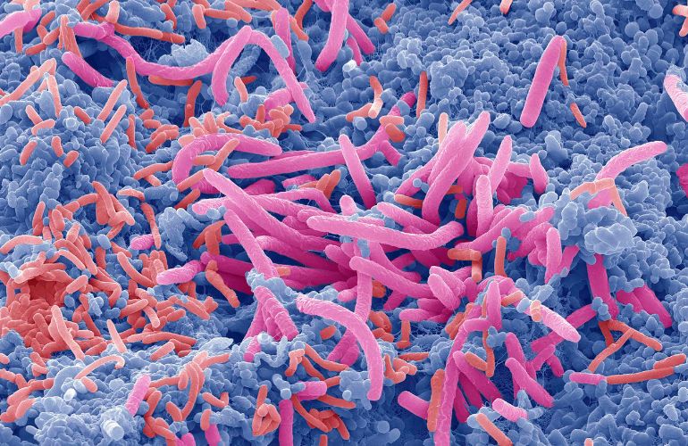 Un estudio trata de esclarecer la relación entre el estilo de vida y la microbiota intestinal y oral