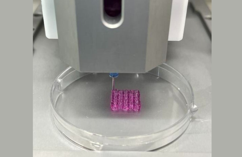 Tecnología de bioimpresión 3D para eliminar células cancerosas