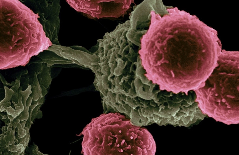 GlyCanDrug, el proyecto internacional para crear moléculas sintéticas contra el cáncer