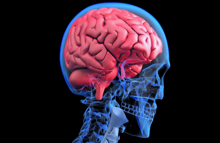 Un tumor cerebral raro responde al tratamiento dirigido con un éxito &#8220;sin precedentes&#8221;