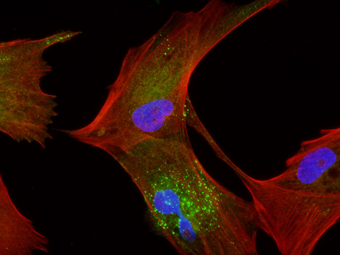&Aacute;ngela Nieto, bi&oacute;loga del CSIC: &laquo;El gran reto es impedir las met&aacute;stasis del c&aacute;ncer&raquo;