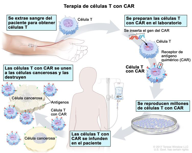 El hospital de Salamanca aplicar&aacute; este mes sus dos primeras terapias CAR-T como centro de referencia nacional