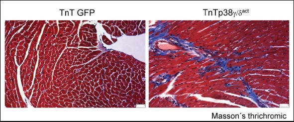 Descubren dos prote&iacute;nas esenciales para el metabolismo del coraz&oacute;n del reci&eacute;n nacido