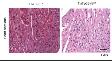 Descubren dos proteínas esenciales para el metabolismo del corazón del recién nacido
