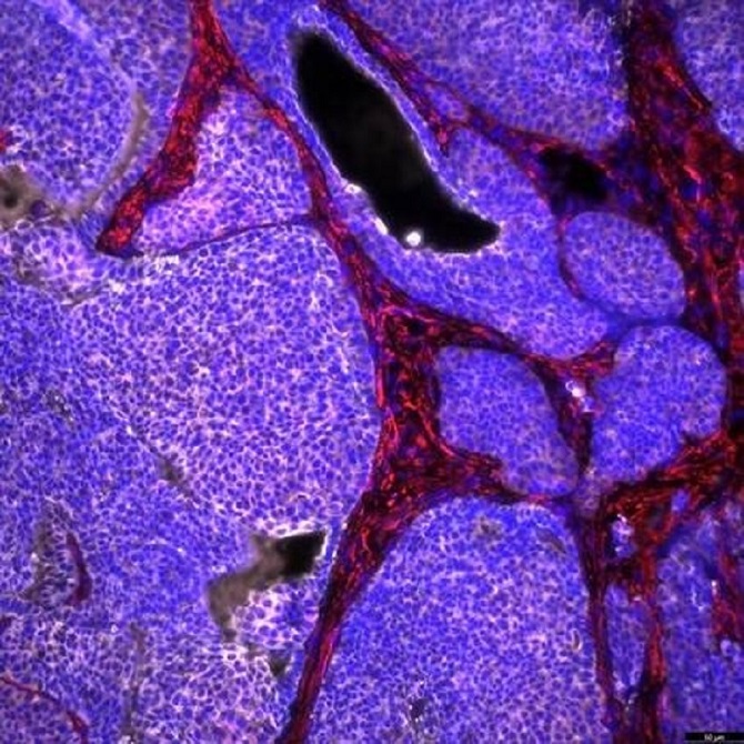 Nace Conexi&oacute;n-C&aacute;ncer, la red que impulsar&aacute; la investigaci&oacute;n oncol&oacute;gica de los centros del CSIC