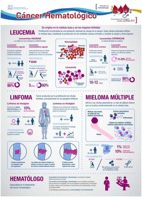 La incorporaci&oacute;n de la inmunoterapia CAR, gran esperanza frente al c&aacute;ncer de la sangre