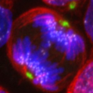 Desvelan los mecanismos que originan la leucemia pedi&aacute;trica m&aacute;s com&uacute;n