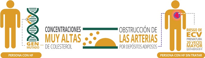La identificación y el tratamiento de las personas con hipercolesterolemia familiar podría evitar 25.000 episodios cardiovasculares