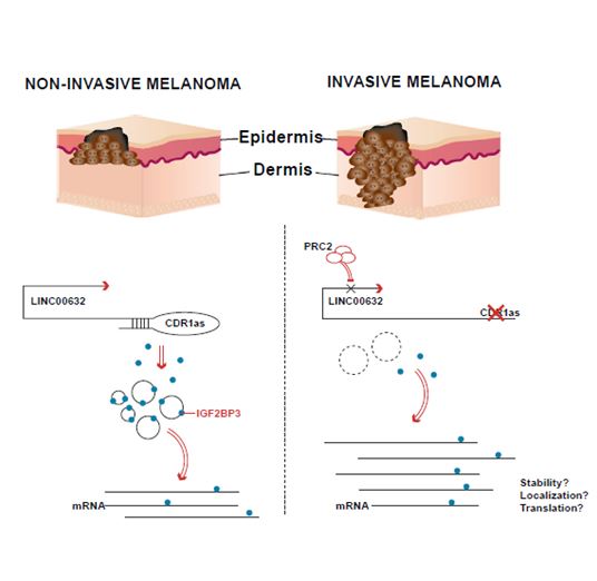 Nuevas v&iacute;as para frenar la met&aacute;stasis del melanoma