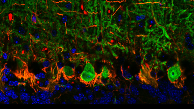 Logran mejoras en el movimiento y en el olfato de ratones con da&ntilde;o cerebral mediante el trasplante de c&eacute;lulas madre