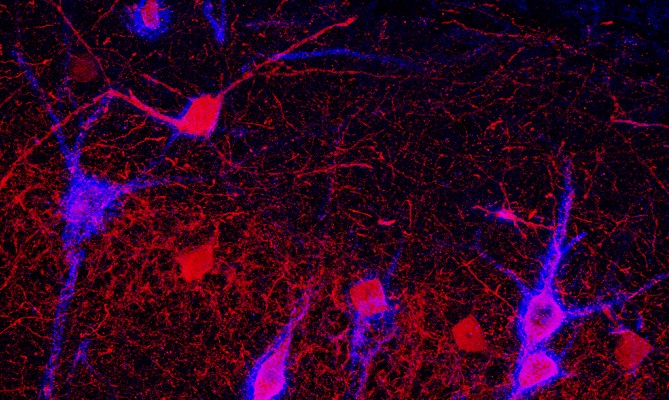 Nuevos datos acerca de las alteraciones del cerebro en enfermedades psiqui&aacute;tricas
