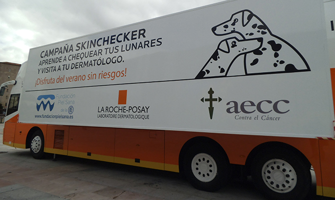 ‘Chequear’ los lunares, una pr&aacute;ctica eficaz para la detecci&oacute;n precoz del c&aacute;ncer de piel
