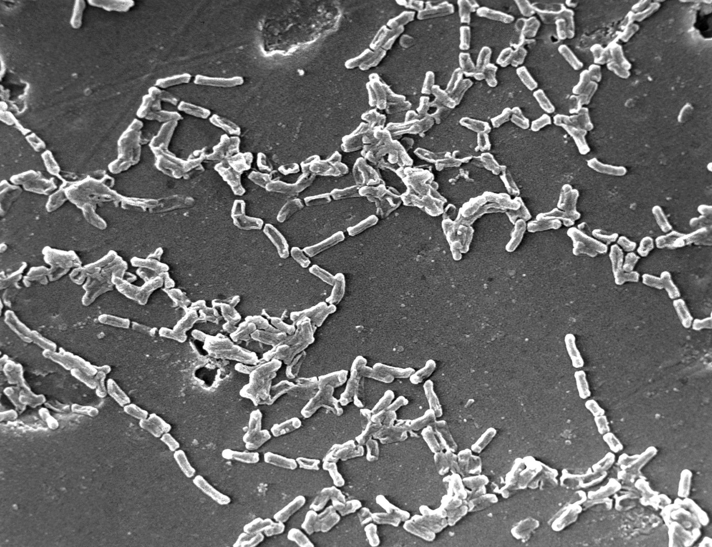 Un virus ayuda a combatir una bacteria multirresistente en un paciente con bajas defensas