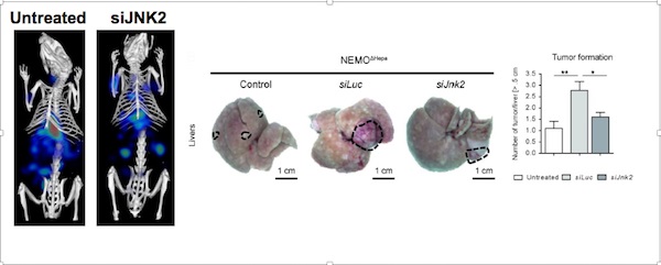 Inactivan con nanotecnolog&iacute;a en ratones un gen involucrado en el desarrollo del c&aacute;ncer de h&iacute;gado m&aacute;s agresivo