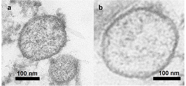 Nuevas vías para tratamientos de patologías neurodegenerativas como el ictus o el párkinson