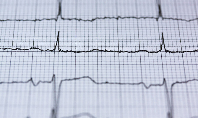 Las muertes por c&aacute;ncer duplican a las cardiovasculares en los pa&iacute;ses m&aacute;s ricos