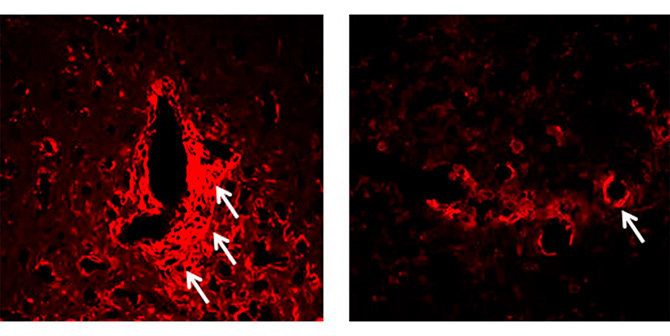 En los modelos animales privados de un ambiente 'enriquecido' (izquierda), se pueden ver en rojo unas células del sistema nervioso llamadas microglia que, al activarse, provocan inflamación, daño en la mielina y en las neuronas. Estos signos se redujeron notablemente en los animales expuestos a un ambiente 'enriquecido' (derecha) / Instituto Leolir El ejercicio físico y otros estímulos podrían reducir el daño cerebral en la esclerosis múltiple