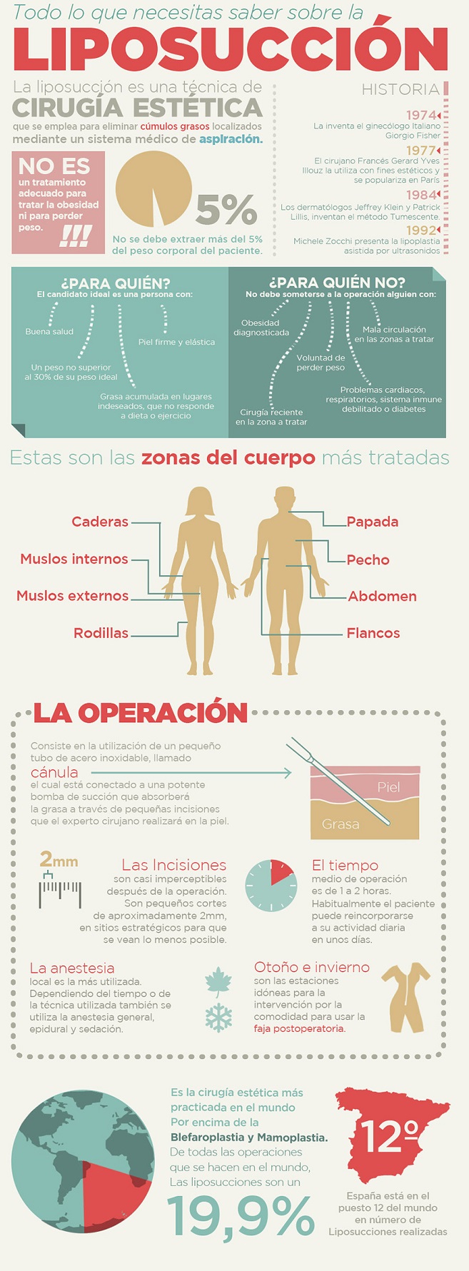 Espa&ntilde;a realiza m&aacute;s de 13.000 liposucciones cada a&ntilde;o