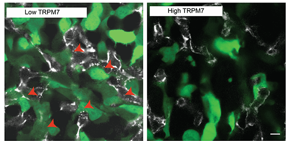 Células cancerosas (verde) que ingresan a los vasos sanguíneos (blanco) de un embrión de pollo. Las células cancerosas con niveles bajos de TRPM7 se intravasan fácilmente (flechas rojas) mientras que las células con niveles altos de TRPM7 apenas invaden los vasos. / UPF Este es el mecanismo molecular que promueve el inicio de la metástasis tumoral