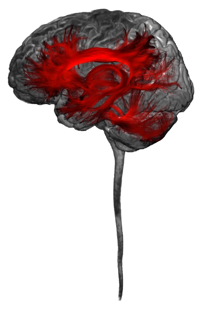 Un m&eacute;dico franc&eacute;s convierte en obras de arte las pruebas de resonancia magn&eacute;tica del cerebro
