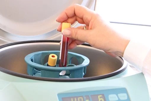 C&oacute;mo entender los resultados de un an&aacute;lisis de sangre