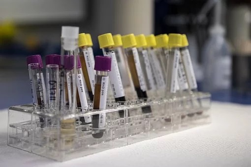 C&oacute;mo entender los resultados de un an&aacute;lisis de sangre