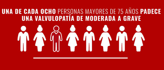 Las valvulopat&iacute;as cardiacas afectan al 3% de las personas mayores de 65 a&ntilde;os en Espa&ntilde;a