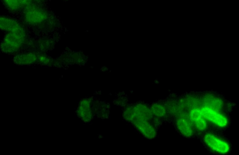 Controlar la forma celular abre v&iacute;as terap&eacute;uticas contra la salmonelosis