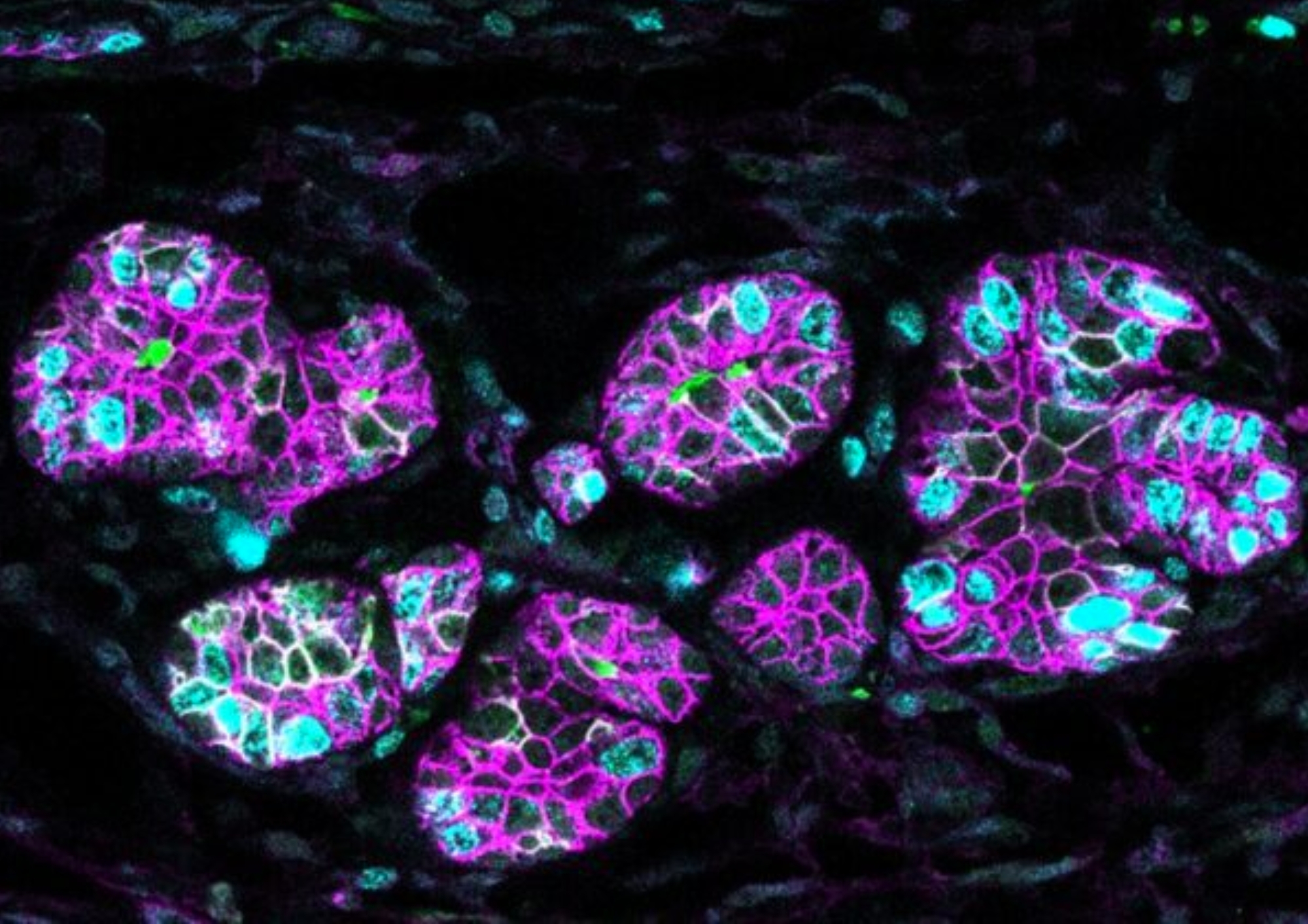 Una proteína clave en la lactancia lo es también en el cáncer de mama