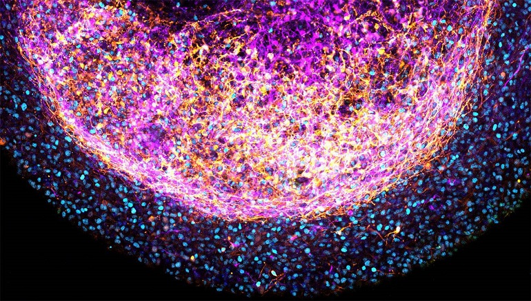 Nuevos organoides que podrían revolucionar la investigación sobre el cerebro