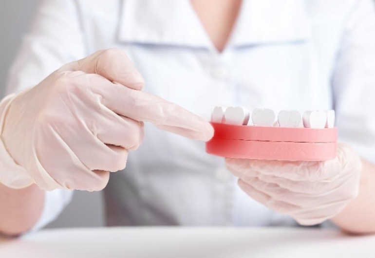 Padecer periodontitis avanzada multiplica por cuatro el riesgo de diabetes
