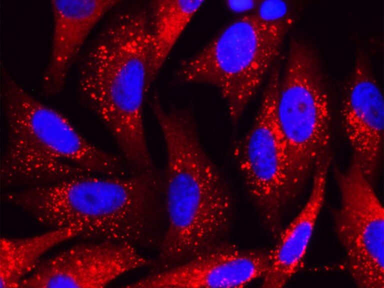 La combinación de ayuno y quimioterapia podría mejorar la respuesta contra el cáncer, y el efecto varía según el sexo