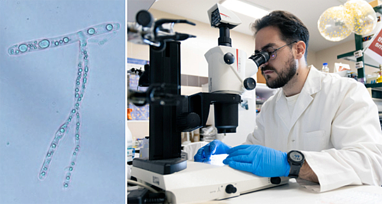 Ingeniería genética con el hongo ‘Ashbya gossypii’ para convertir residuos agrícolas y domésticos en productos de alto valor para la salud