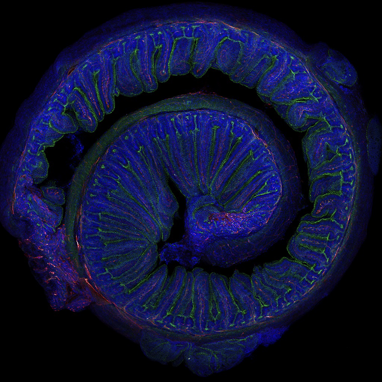 La microbiota modula el impacto positivo del ejercicio físico moderado sobre la memoria