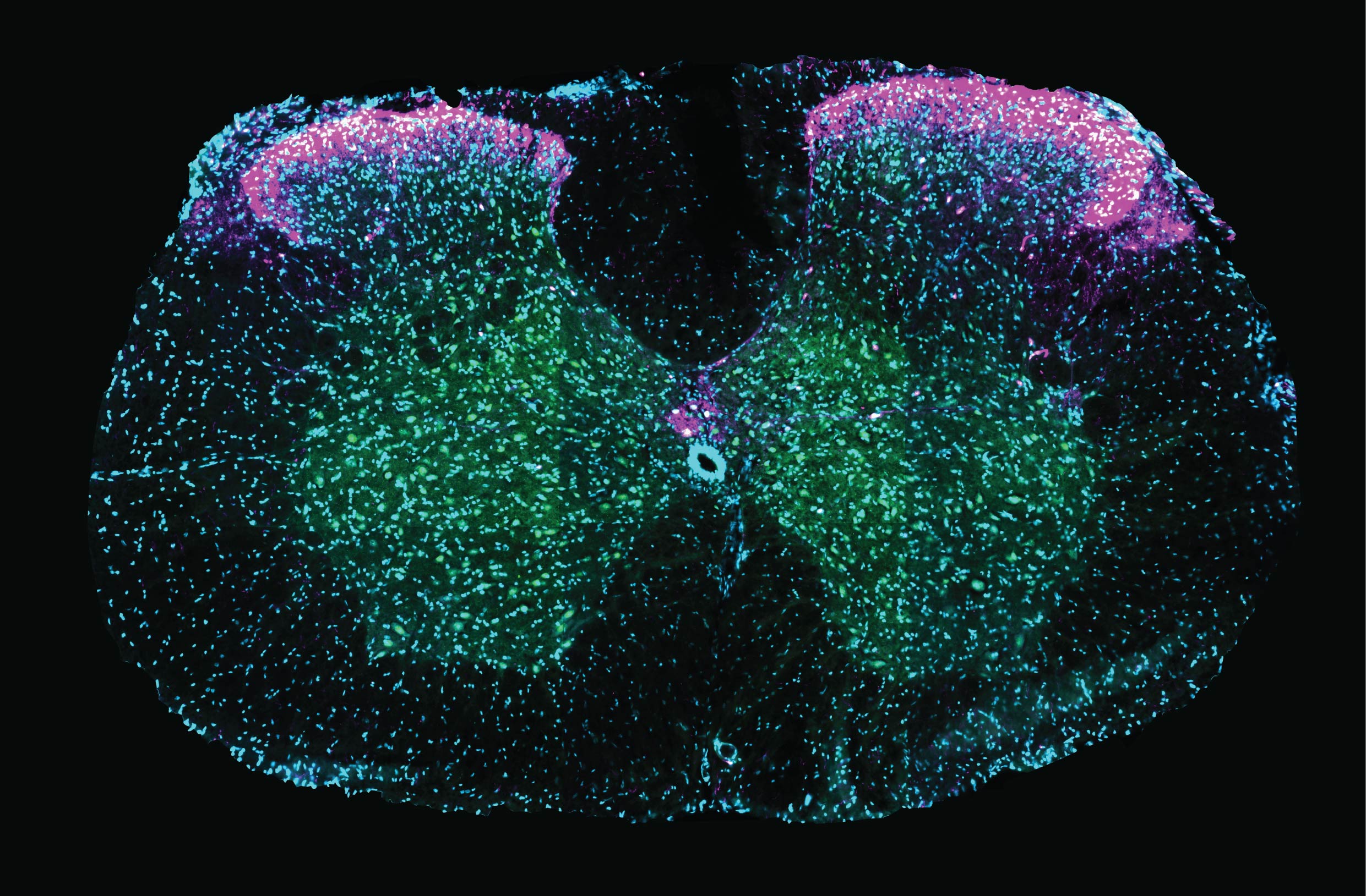 No solo cerebro: la médula espinal tiene un papel en el sexo más relevante del esperado