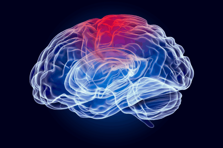 Localizan las zonas cerebrales más afectadas en la fase inicial de pacientes con trastornos del espectro de la esquizofrenia