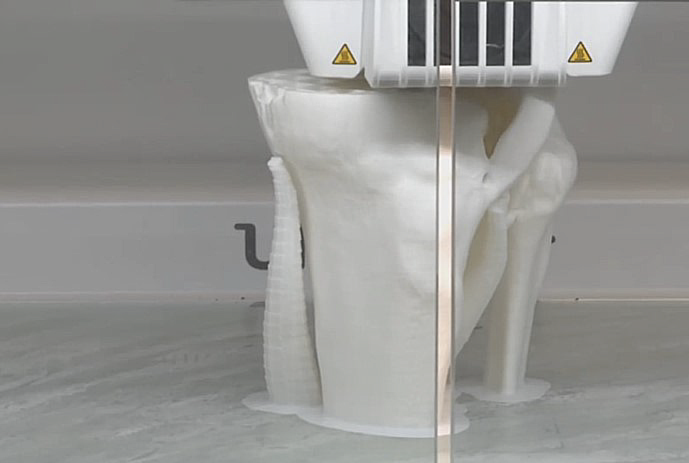 El Río Hortega de Valladolid, primer hospital de Castilla y León en impresión 3D