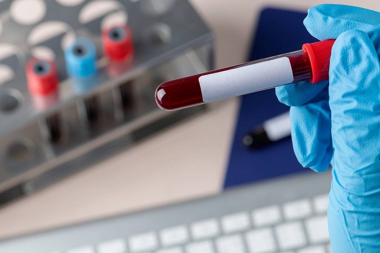 Investigadores españoles mejoran la eficiencia y seguridad de las terapias génicas para enfermedades de la sangre