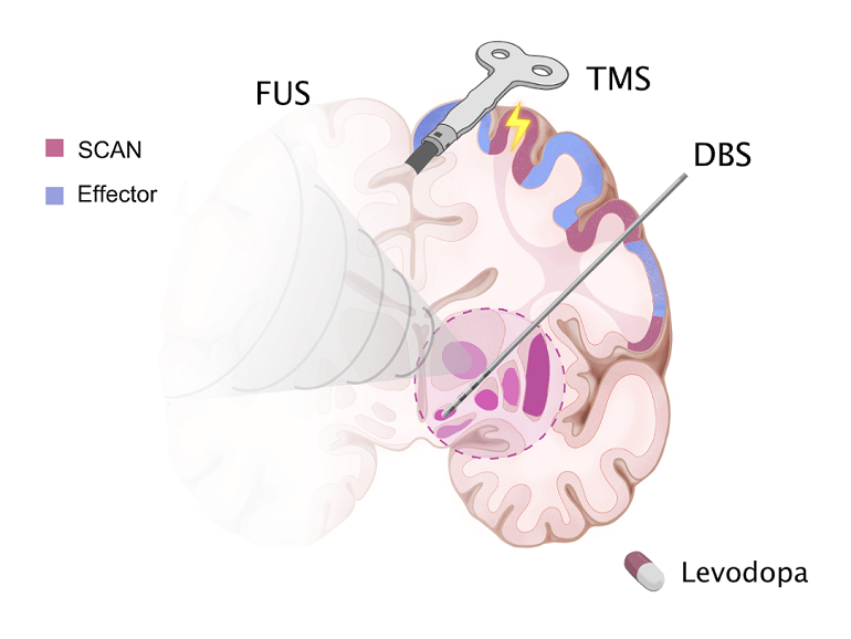 La red que conecta cuerpo y mente, clave para mejorar los tratamientos del p&aacute;rkinson