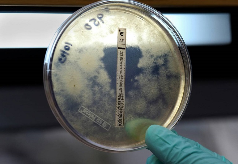 Meningitis B: qué saber tras el brote en Reino Unido y la situación en España