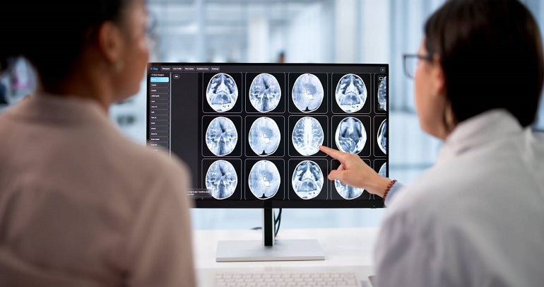 Un an&aacute;lisis de sangre y un nuevo esc&aacute;ner cerebral detectan se&ntilde;ales de alzh&eacute;imer a&ntilde;os antes de los s&iacute;ntomas